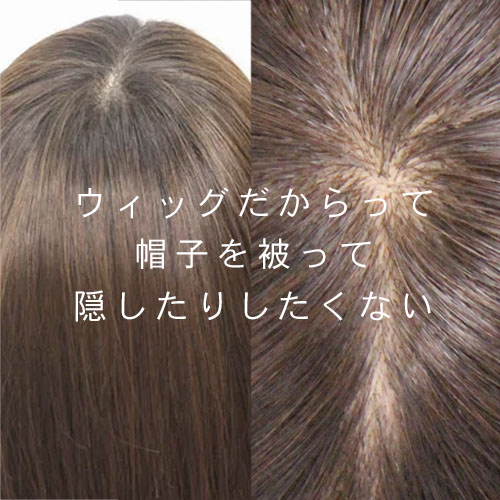 医療用ウィッグの頭頂部のアップと、つむじのアップ