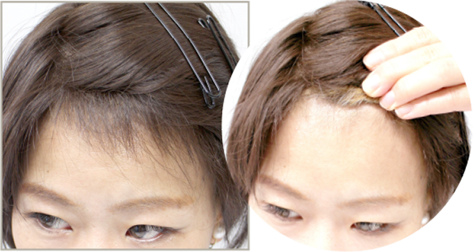 ウィッグの生え際のうぶ毛と、ウィッグをめくった生え際の比較